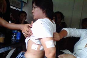  Pelaku Lepaskan 3 Tembakan, Tantan Ngumpet ke Kedutaan Korut