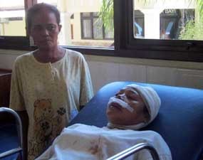 Wanita Pencari Kayu Diserang Orang Tak Dikenal