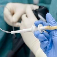Alasan Pasien Takut Biopsi? 
