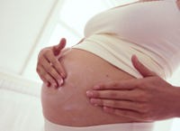 Apa Stretch Marks Bisa Hilang