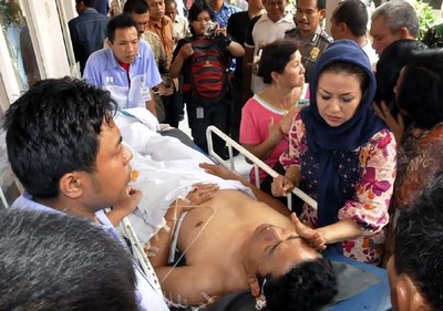 Korban Luka Bom di Masjid Polresta Cirebon