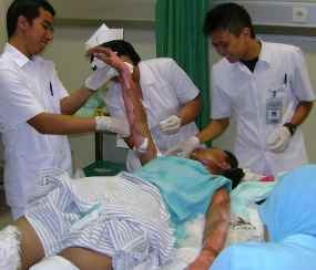 Rumah Terbakar, Sekujur Tubuh Siswi SMK Melepuh