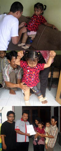 Senang Dapat Dua Kaki Palsu, Dewi Tak Sabar Ingin Sekolah