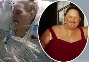 Dari Super Gemuk Jadi Super Kurus, si Gadis Kini Sekarat