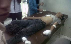 Tawuran Antar Mahasiswa di Kampus UMI Makassar, 1 Kena Tebas