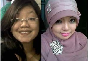 Berjibaku dengan Penyakit Langka Miastenia Gravis