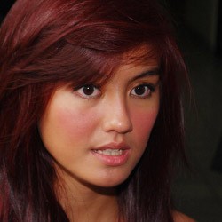 Cedera Bikin Agnes Batal Tampil di Konser GIGI