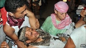 37 Orang Tewas Dalam Pertempuran Pasukan Yaman & Kelompok Oposisi