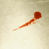 Hematidrosis si Penyakit Keringat Darah