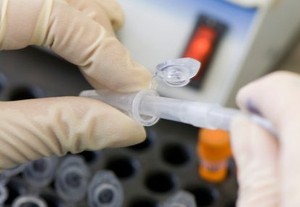 Hasil Terapi Kanker Nasofaring Bisa Dipantau dari DNA Virus