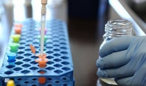 Korban Tewas Wabah E. Coli di Eropa Bertambah Jadi 19 Orang