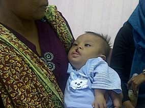 Dokter akan Lakukan Tiga Operasi untuk Bayi Dede Tegar