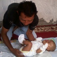 Bayi Tanpa Mulut & Hidung di Magelang Makin Memprihatinkan