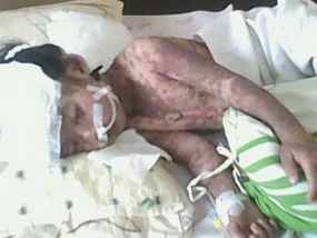 RSU Abdoer Rahem Situbondo Bantah Beri Obat Salah ke Pasien