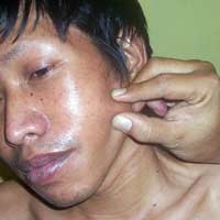Tohari Sempat Berobat ke Dukun Cilik Ponari Namun Tak Sembuh