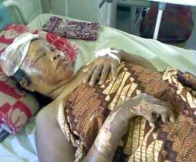 Anak Korban Bantah Ibunya Pembuat Petasan di Rumah