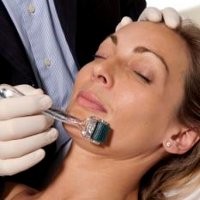 Plasenta Domba Bisa Hilangkan Keriput Selama 5 Bulan 