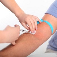 2 Miliar Penduduk Dunia Telah Terinfeksi Hepatitis B