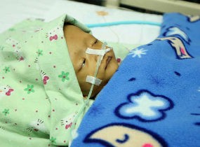 Berat 5,5 Kg, Balita Dapi Pernah Demam Tinggi Saat Usia 6 Bulan