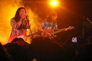 Bassist Navicula yang Terluka di Kepala Sudah Konser Lagi