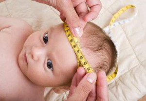 Kepala Anak Microcephalus Mengecil Karena Evolusi Otak