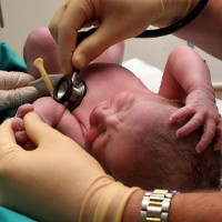 Tes untuk Mengetahui Cacat Jantung Bawaan Pada Bayi