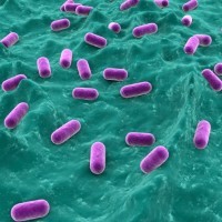 Ciri-ciri Bakteri Lactobacillus