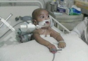 Kena Penyakit Langka, Bayi Kevin Pakai Ventilator Seumur Hidup