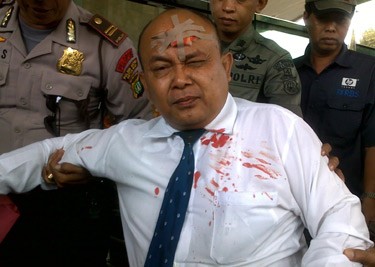 Arifin Nekat Sayat Dahi di Gedung KPK