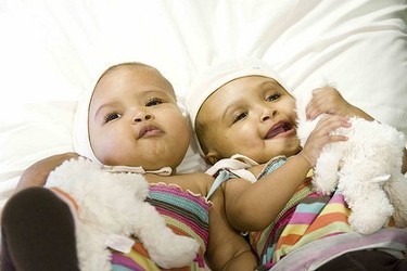 Bayi Kembar Siam Asal Sudan Berhasil Dipisahkan di London