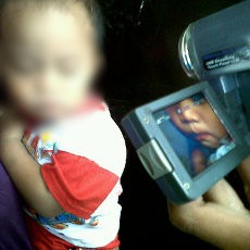 Bila Dibiarkan, Dafa Terancam Alami Gangguan Ginjal dan Saraf