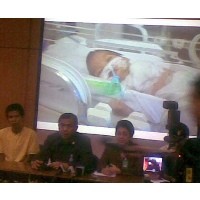 Jantung di Luar Tubuh Bayi Siti Arrahma Sulit Dimasukkan Lagi 