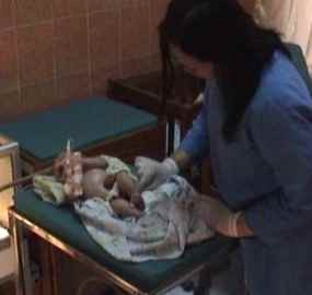 Bayi Lahir Dengan Usus Keluar di Nganjuk Kondisinya Lemah