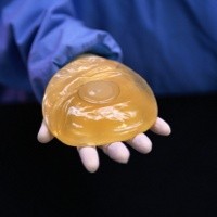 Asal Tidak Bocor, Implan Payudara Aman untuk ASI