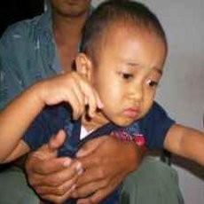 Pasca Operasi Hernia, Bocah Tiga Tahun Buta Hingga Lumpuh