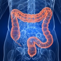 Sindrom Blind Loop, Saat Makanan Tak Lancar Lewati Usus