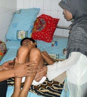 Dikeroyok Teman Sebaya, Pelajar SD Sekarat