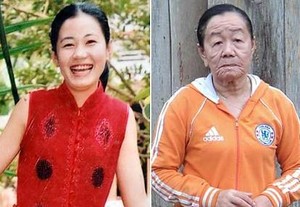 Kulit Wanita 23 Tahun Keriput Seperti Nenek 73 Tahun Karena Obat