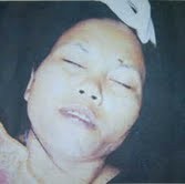 Usut Keterkaitan, Mayat Perempuan di Koja & Cakung Dites DNA