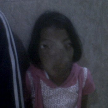  Kisah Yani Penderita Tumor yang Mencari Keringanan Biaya ke Senayan