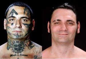 25 Kali Bolak-balik Operasi Laser Demi Hilangkan Tato Nazi