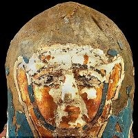 Kanker Prostat Jangkiti Mumi Berusia Ribuan Tahun