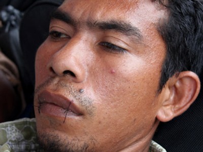 Jahit Mulut Tuntut Menhut