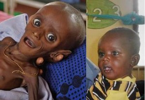 Wajah Baru Minhaj, Bocah Somalia yang Sempat Sekarat Kelaparan
