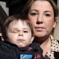 Mata Balita Tak Bisa Terbuka Karena Dokter Salah Beri Lem