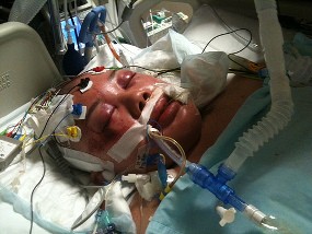 Dua WNI Dikabarkan Tewas Tertabrak Mobil di Singapura