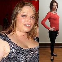 Ingin Langsing dengan Operasi Lambung Malah Jadi Kurang Gizi