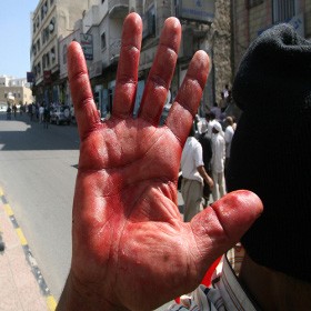  Sniper  Tembak Mati Demonstran Wanita di Yaman!