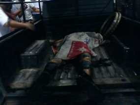 Masih Hidup, Pria yang Bakar Diri di Depan Istana Luka Serius 