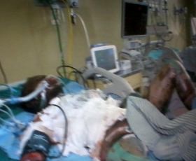 SBY Minta Nyawa Pelaku Bakar Diri Diselamatkan